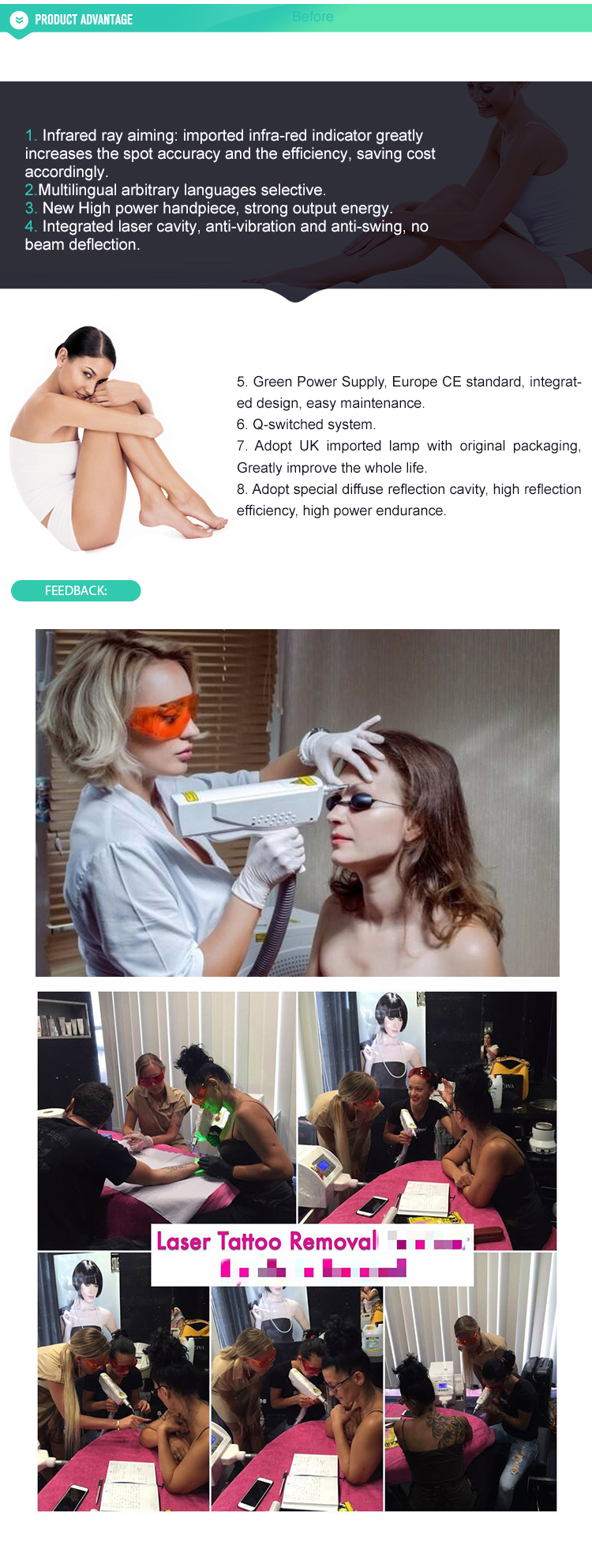 Factory Supply High Quality Portable ND-YAG laser tattoo removal system/new laser for tattoo removal machine price