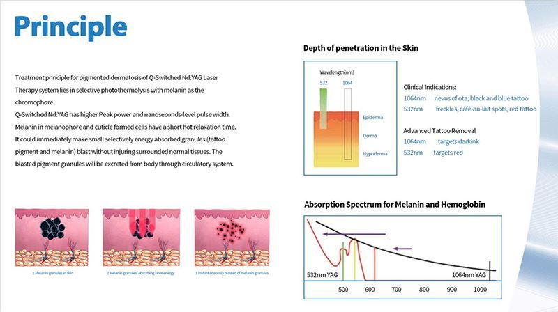 Q-laser remove acne Q-laser remove acne