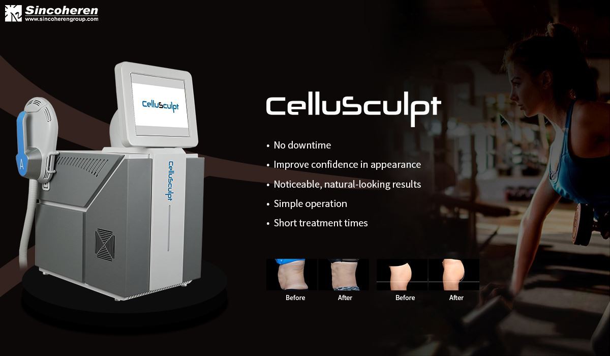 Portable CelluSculpt.1