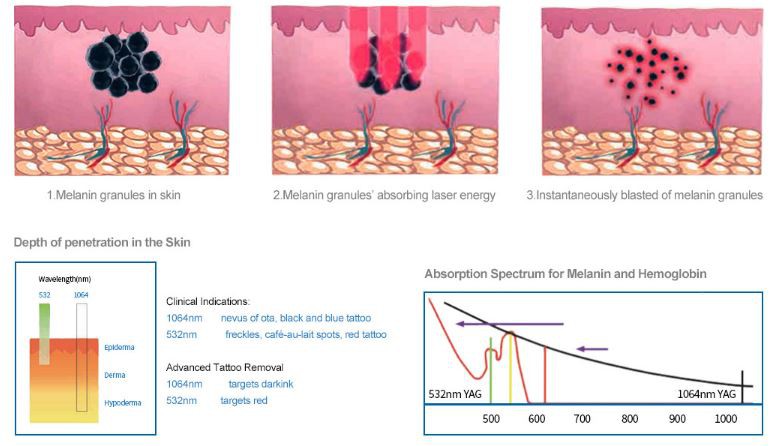~QT_MHA``6FV_G{8YA$T1P0