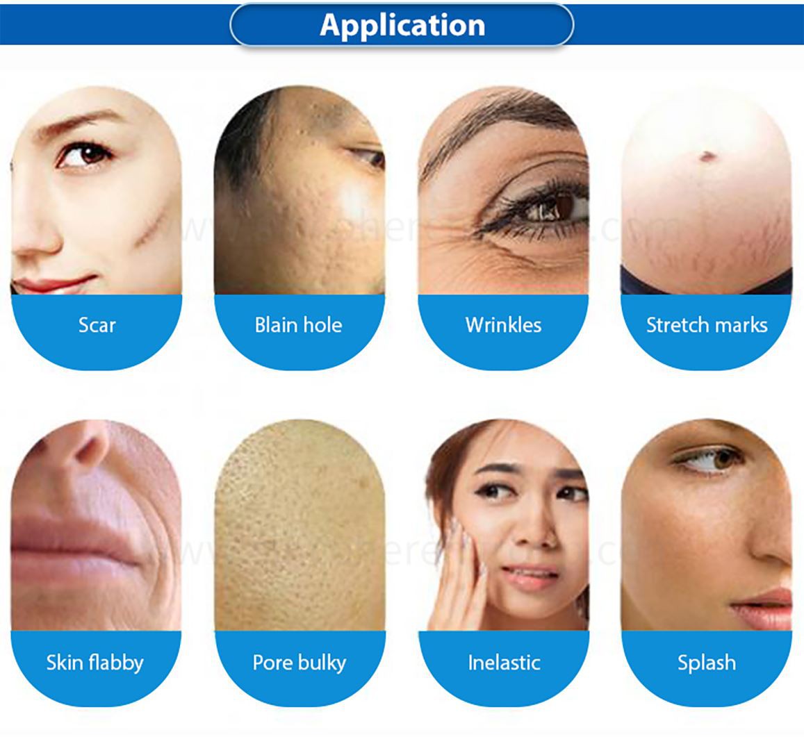 3-in-1-microneeding-(5) 3-in-1-microneeding-(5)