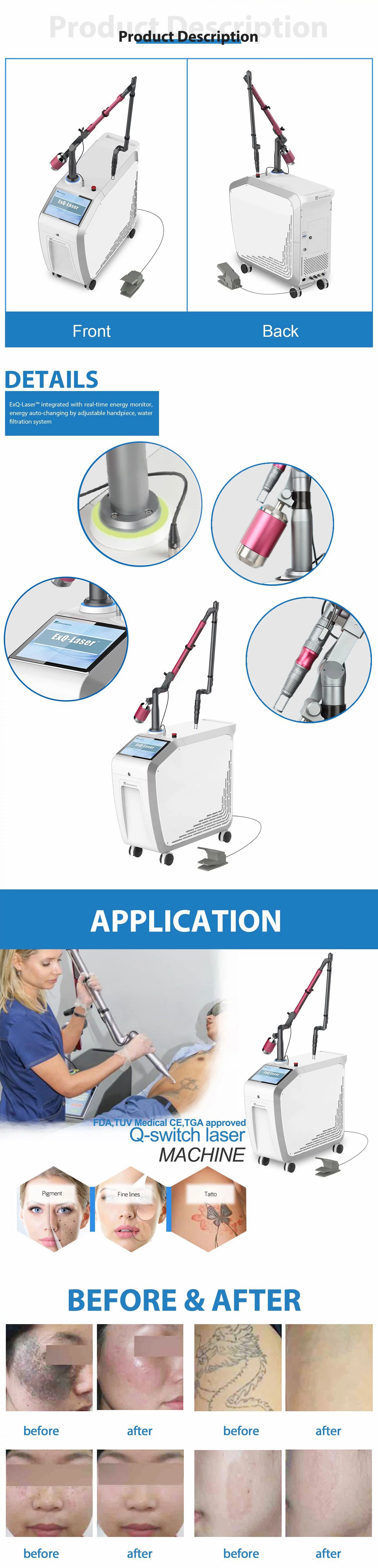 Q Switch ND YAG remove tattoos Q Switch ND YAG remove tattoos