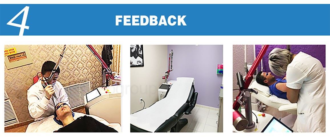 picosure tattoo removal machine