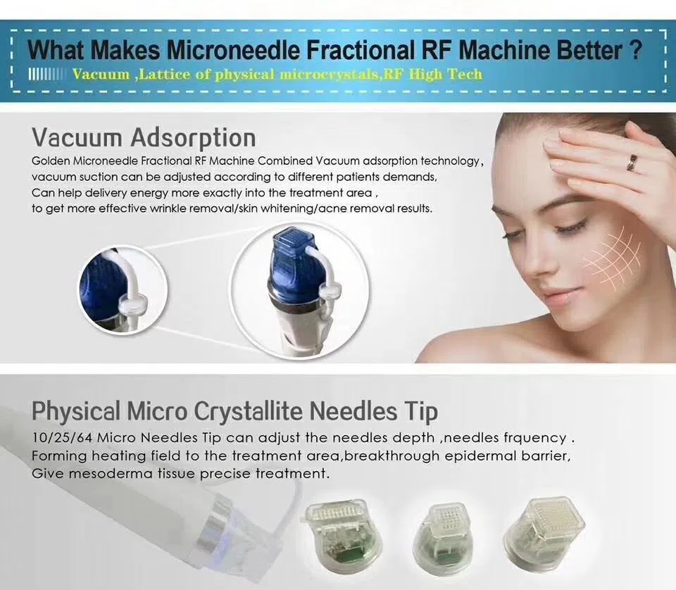 microneedling