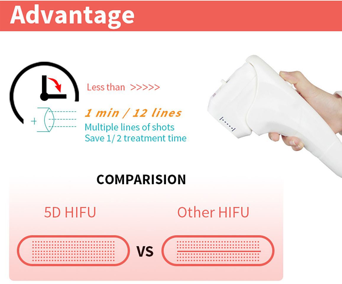 5D-HIFU-(6) 5D-HIFU-(6)