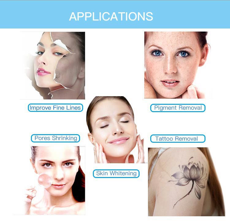 FAQ and CE approved Q-Switched NdYAG Laser Tattoo Removal and pigment removal Machine with 1064nm and 532nm  applications