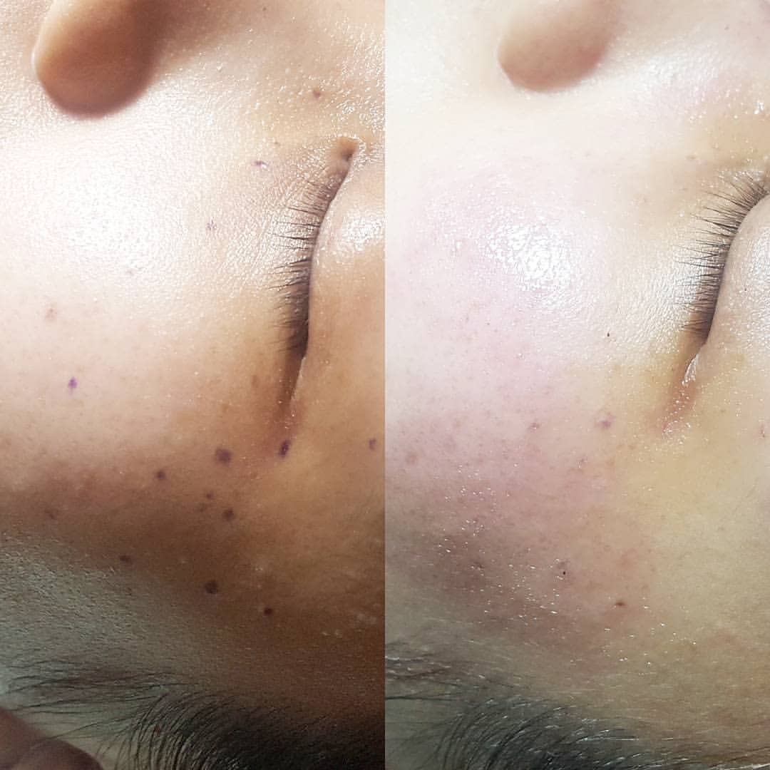 before after4 before after4