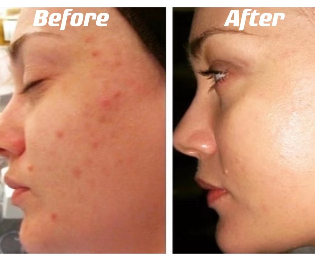 before after5 before after5