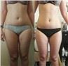 /uploads/202234052/small/cavitation-rf-weight-loss-fat-removal-machine41542159221.jpg