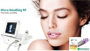 Fine Lines Wrinkles Micro Needling RF