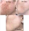 /uploads/202134052/small/ipl-laser-hair-removal-skin-tightening29494885900.jpg