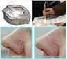 /uploads/202234052/small/laser-machine-980-for-spider-vein-removal33156965995.jpg