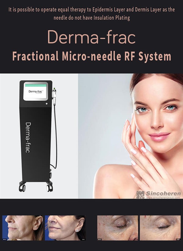 Microneedle Fractional Radiofrequency Machine