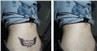 /uploads/202234052/small/mini-portable-nd-yag-fast-result-tattoo59043586438.png