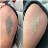 /uploads/202234052/small/portable-homeuse-nd-yag-tattoo-removal-laser37359806881.jpg