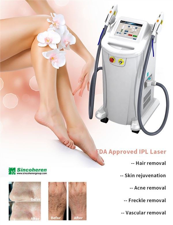 Skin Rejuvenation IPL Treatment Beauty Machine
