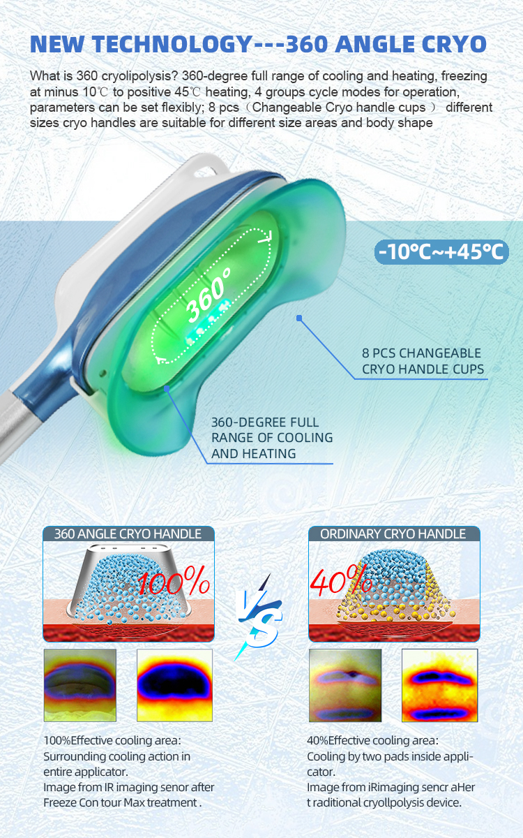 the working principle