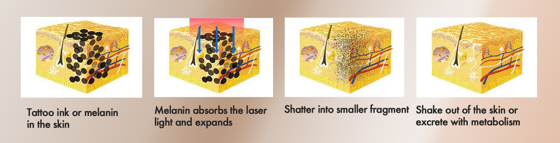 working principle working principle