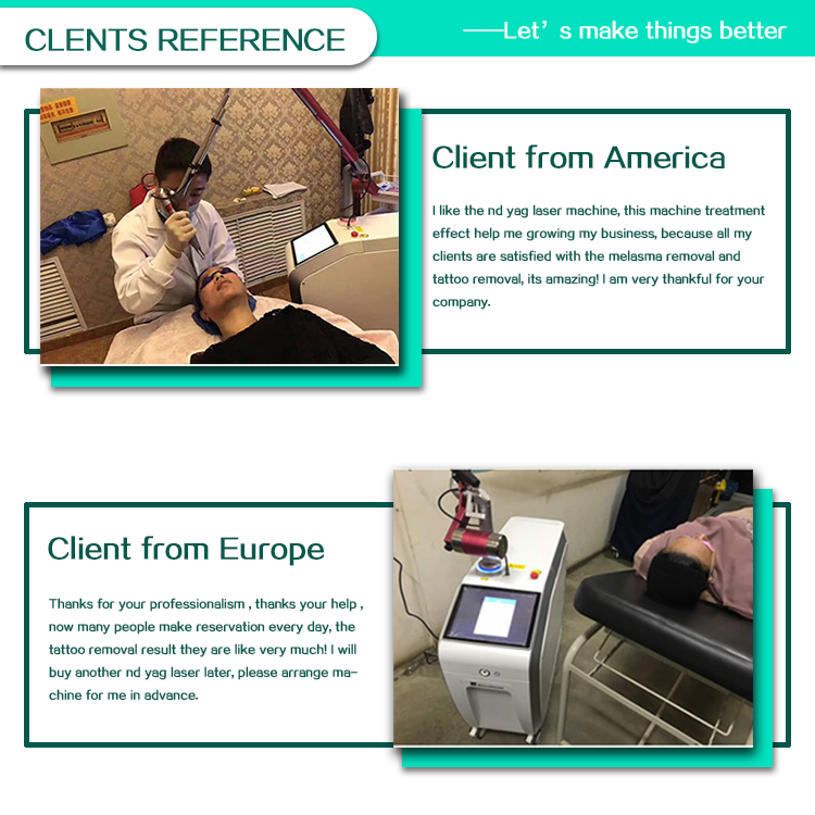 Q Switch ND YAG Tattoo Removal Machine