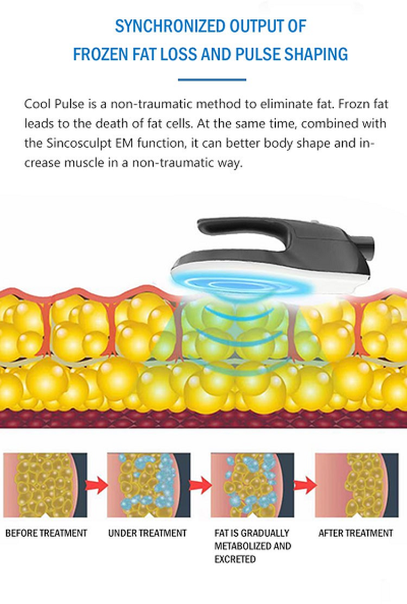 cool pulse ems details 4 cool pulse ems details 4