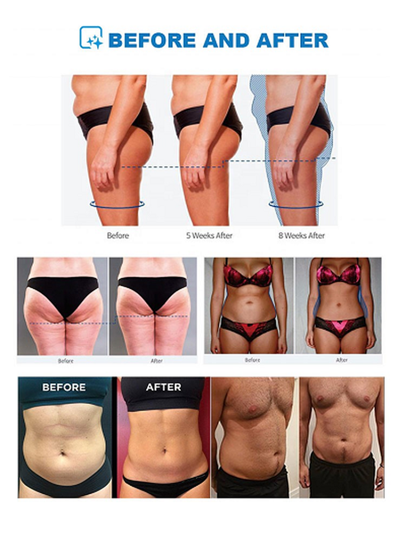 cool pulse ems details 5 cool pulse ems details 5