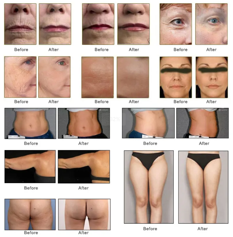 before and after before and after