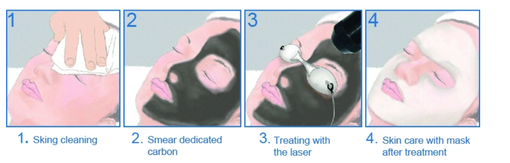 PROCEDURE PROCEDURE