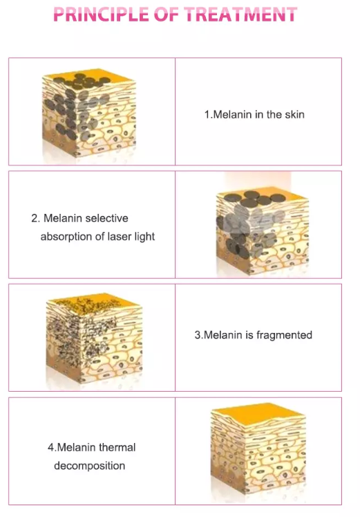 WORKING PRINCIPLE WORKING PRINCIPLE