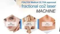 How Long Can The Micro-needle Fractional Rf Machine Effect Last