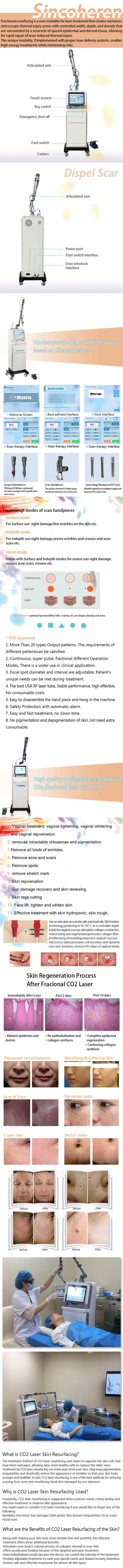 Fractional Laser Machine