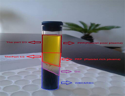 PRP tubes