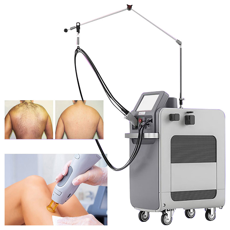 Gentlemax Pro ND YAG laser Hair Removal Machine